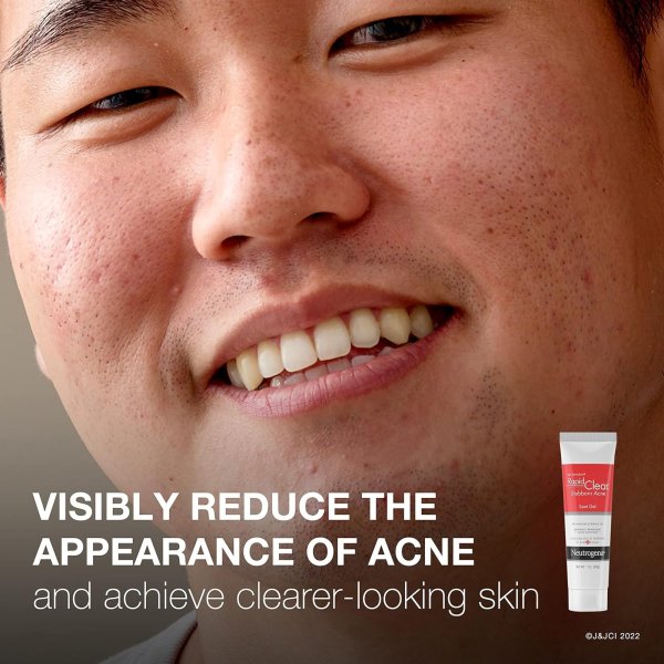Neutrogena Rapid Clear Stubborn Acne Spot Treatment Gel, 1 oz