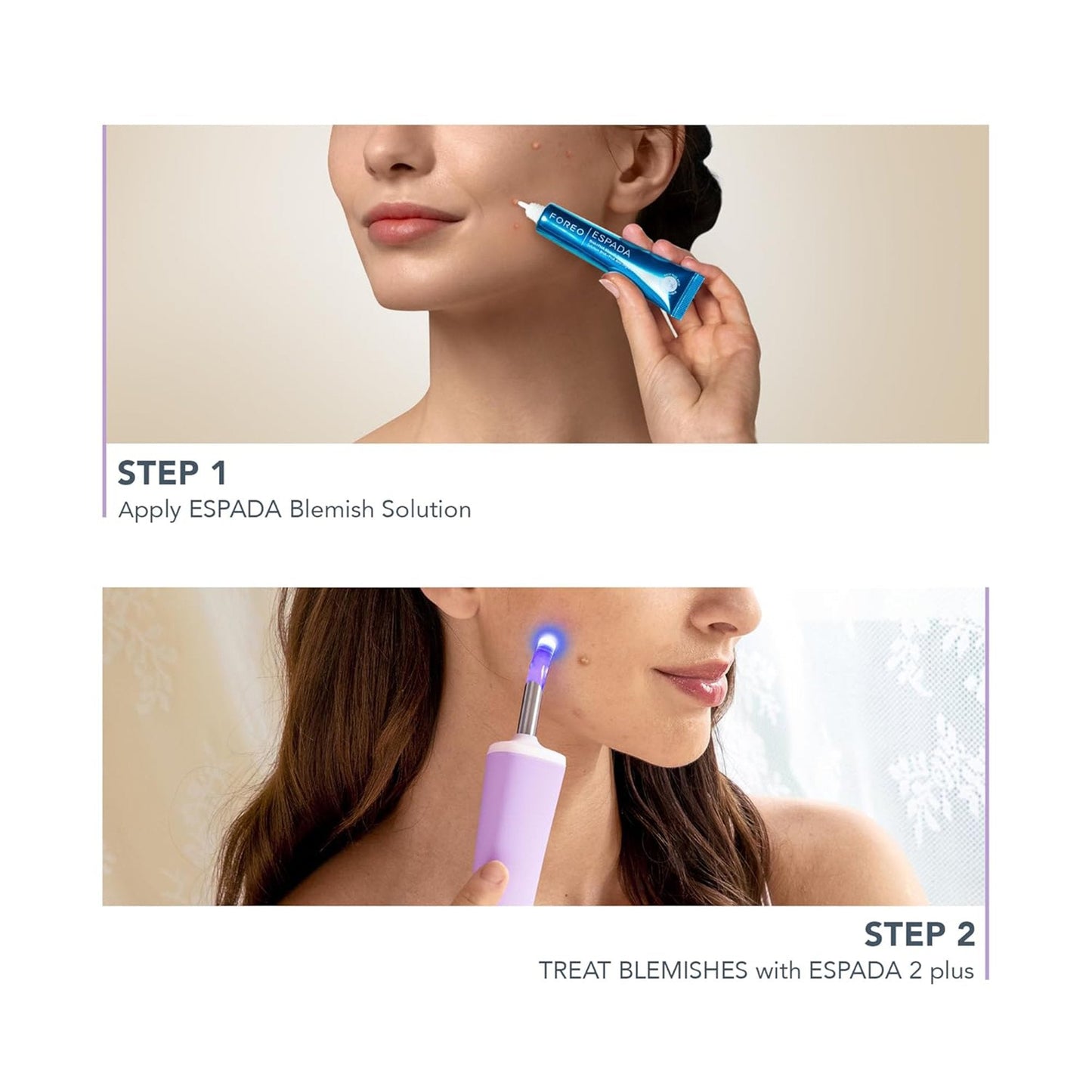 ESPADA 2 Plus Acne Therapy Device