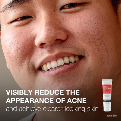 Neutrogena Rapid Clear Stubborn Acne Spot Treatment Gel, 1 oz