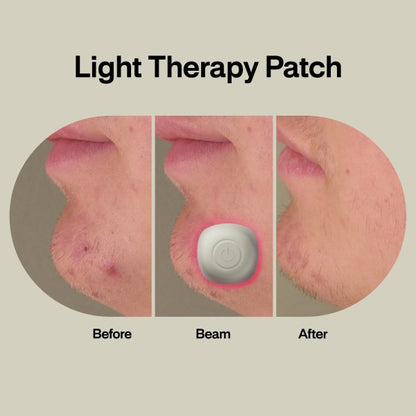 l.a.b. Light Acne Light Therapy Patch Kit. 2 Pack