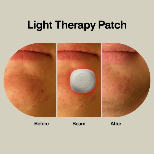 l.a.b. Light Acne Light Therapy Patch Kit