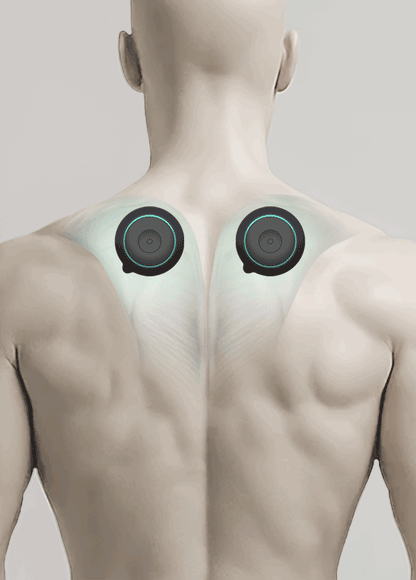 Chirp Halo Wireless TENS and EMS Pain Relief Therapy Unit