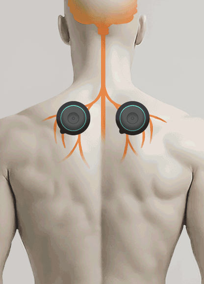 Chirp Halo Wireless TENS and EMS Pain Relief Therapy Unit